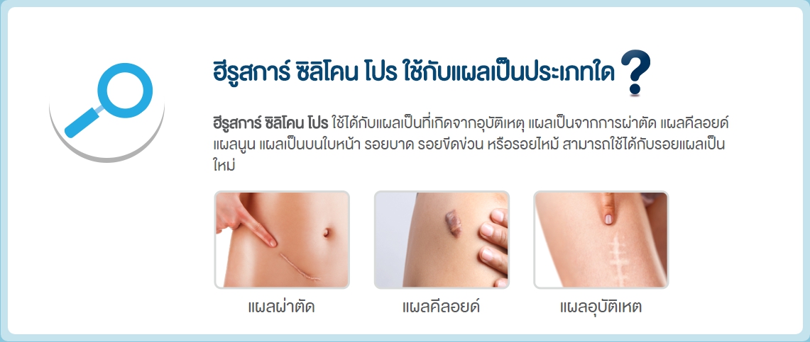 Hiruscar Silicone Pro 4g ราคา,Hiruscar Silicone Pro 4g รีวิว,Hiruscar Silicone Pro,Hiruscar,ฮีรูสการ์,เจลลบรอยแผลเป็น,เจลลดรอยแผลเป็น,ลดเลือนรอยแผลเป็น,hiruscar gel,hiruscar silicone,ฮีรูสการ์เจล